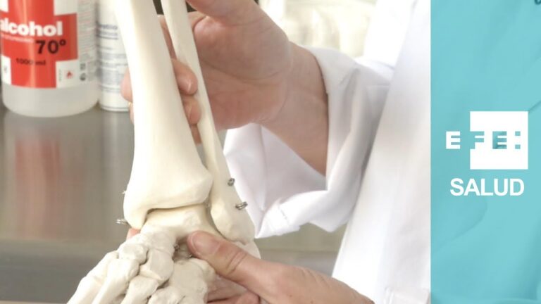 Fractura de la Tibia y Peroné: Causas, Síntomas y Tratamientos ...