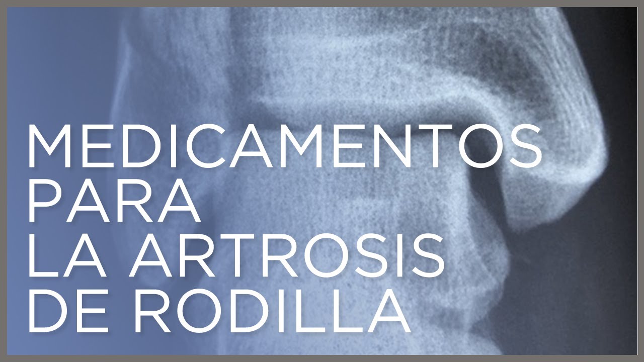 los mejores antiinflamatorios para la artrosis
