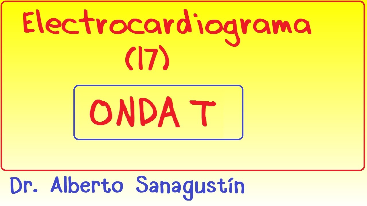 onda t negativa en v1 y v2