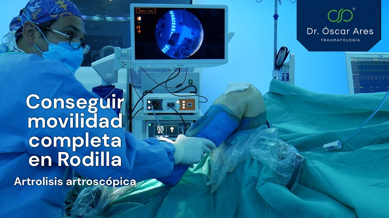 tiempo de recuperación de una artrolisis