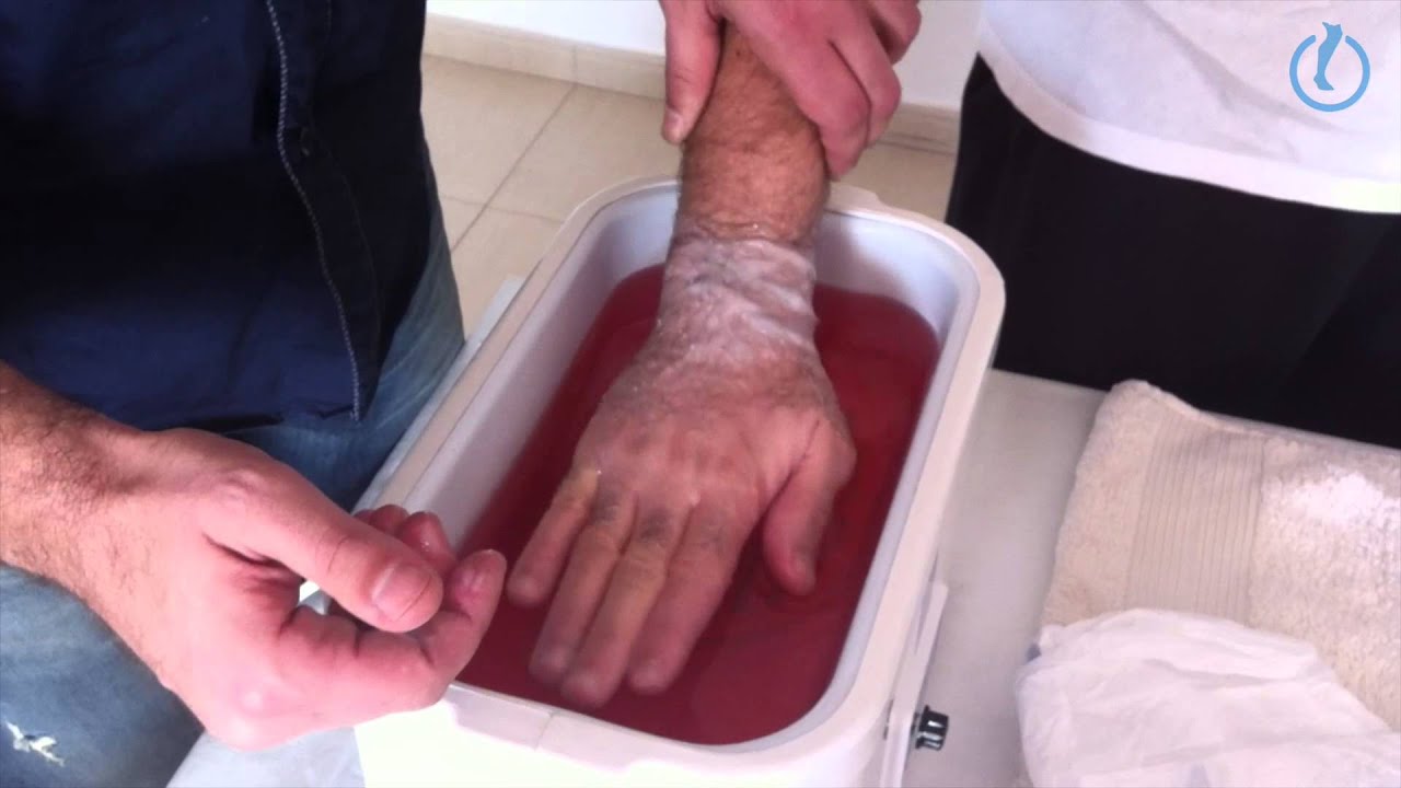 baños de parafina para manos con artrosis
