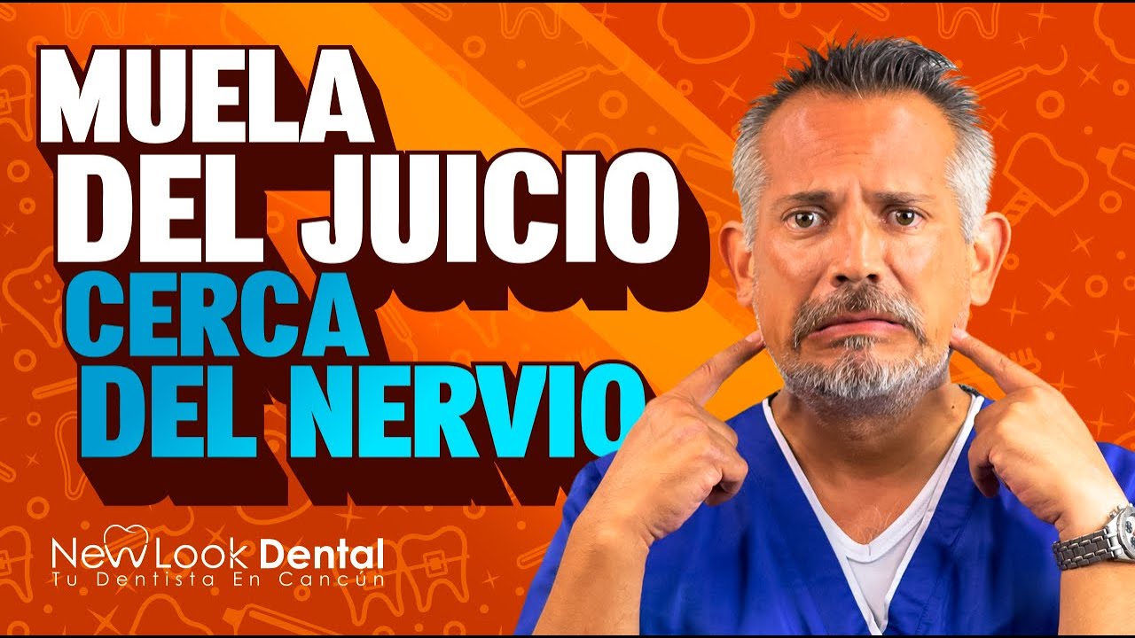 cirugia maxilofacial muela del juicio riesgos