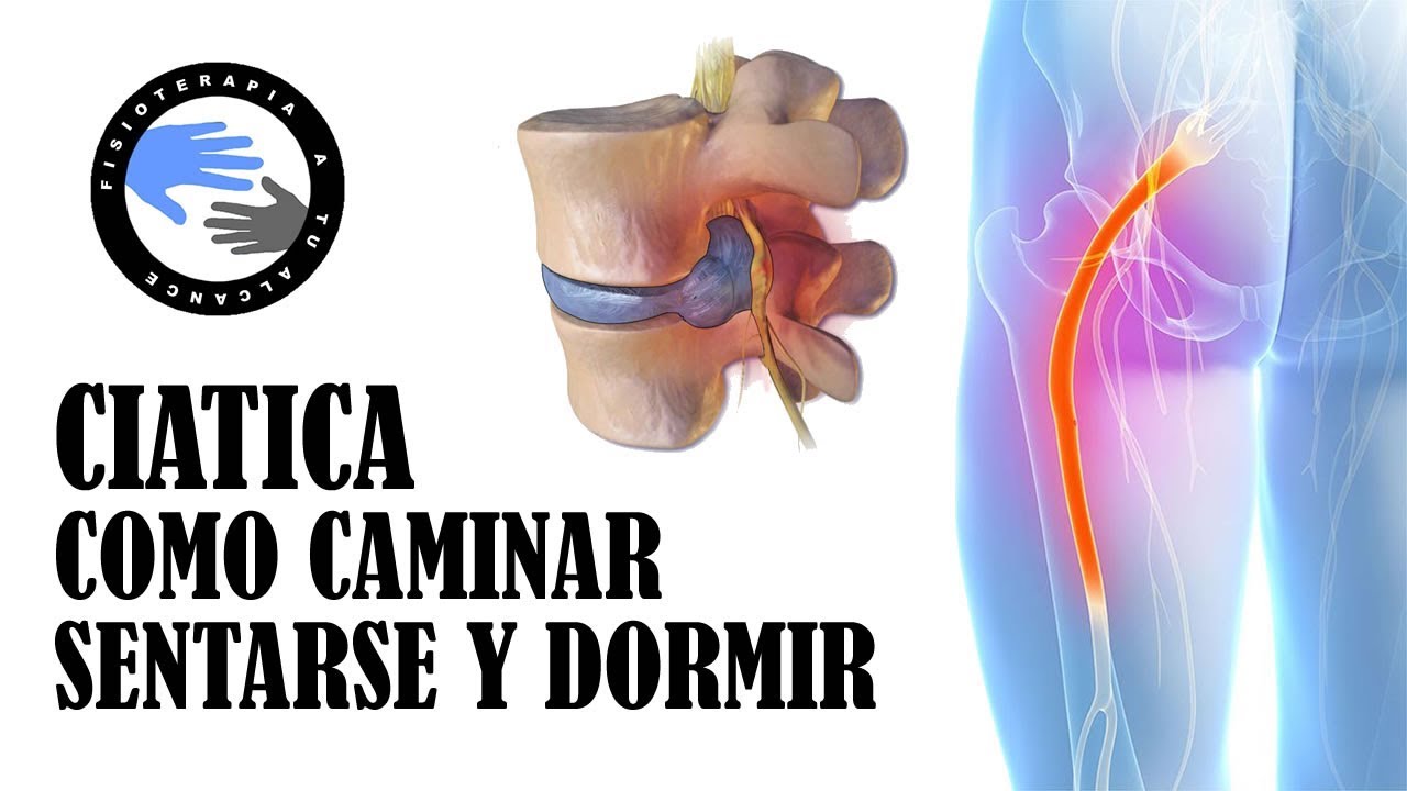 como aliviar el dolor de ciatica por hernia discal