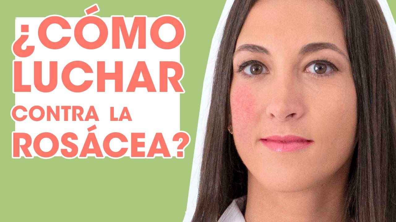 como quitar rojeces de la cara en un día