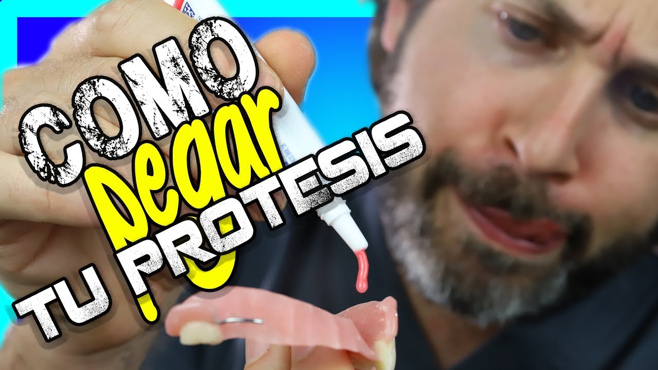como sujetar la prótesis dental inferior
