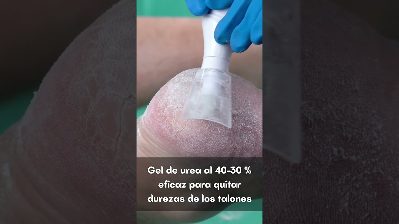 crema de urea al 30 por ciento