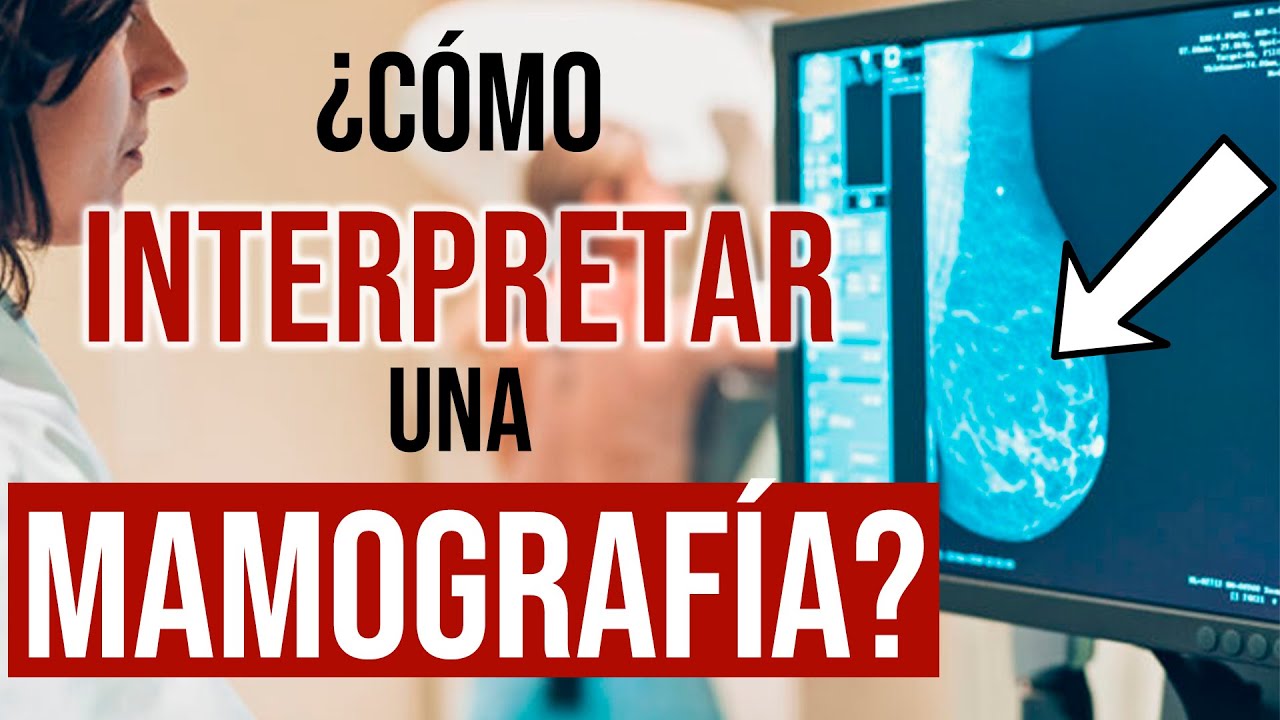 cuanto tardan los resultados de una ecografia de mama