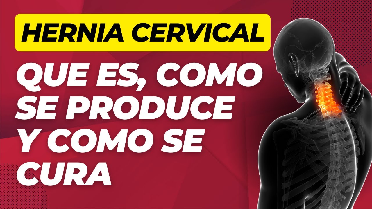 discopatia degenerativa cervical c5 c6 c7 tratamiento