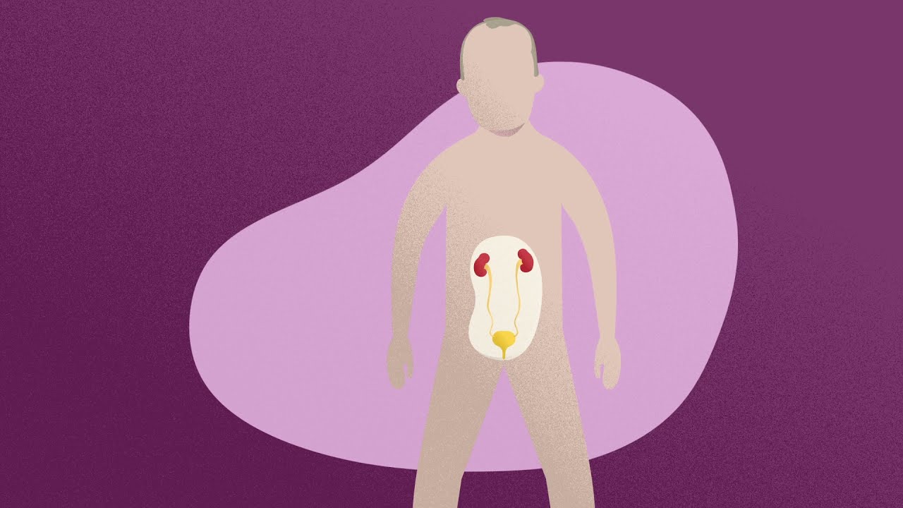 grado de discapacidad por cáncer de vejiga