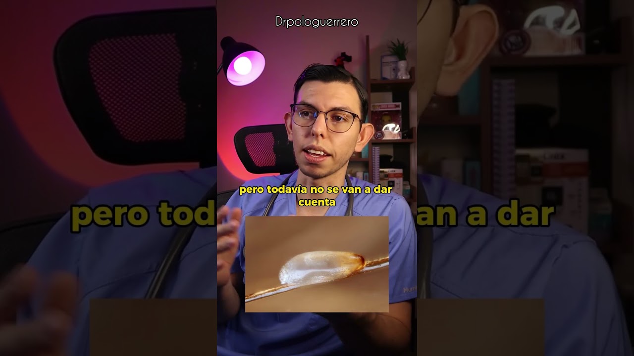 los piojos viven fuera de la cabeza