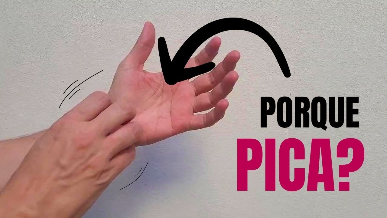 me pican las palmas de las manos