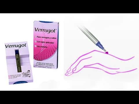 nitrato de plata para cicatrizar heridas