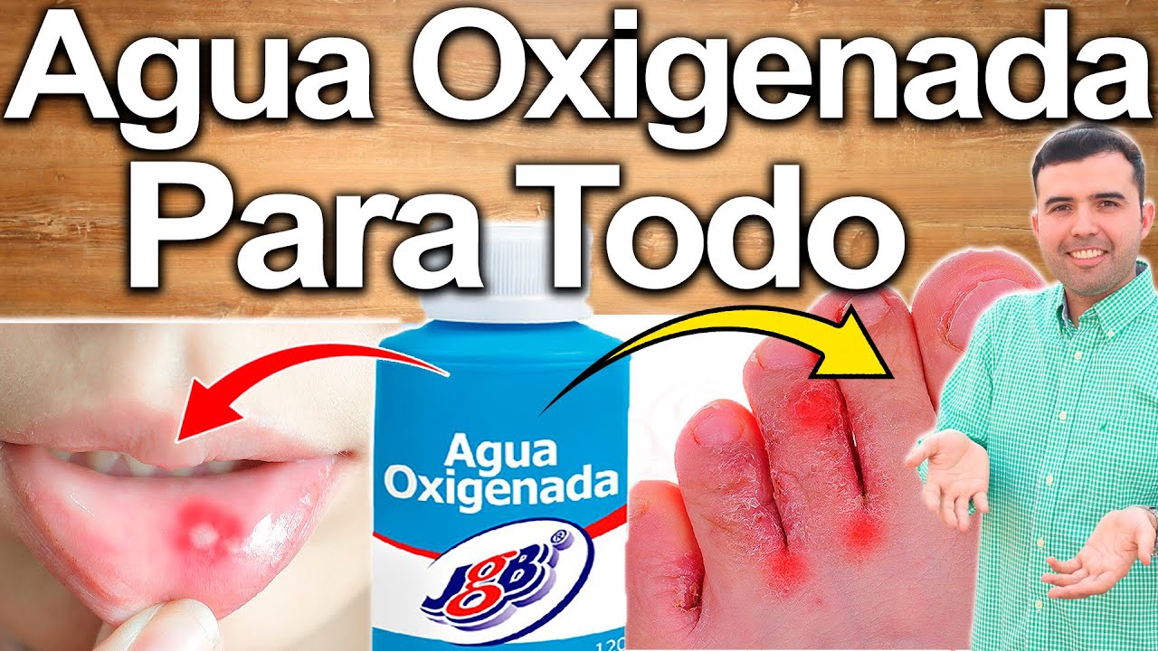 para qué sirve el agua oxigenada