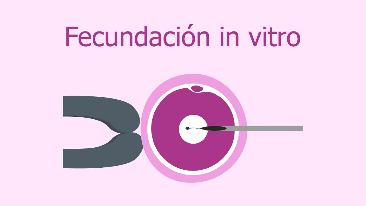 proceso in vitro paso a paso