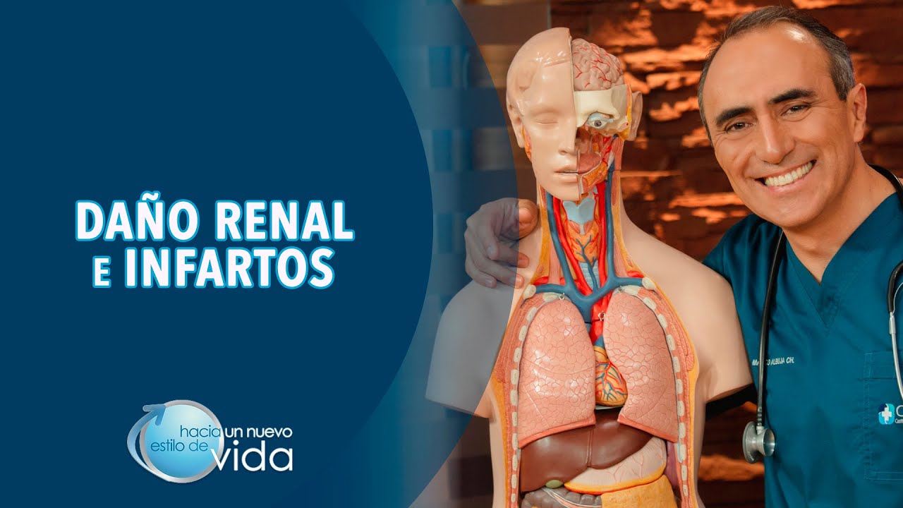 qué es un infarto renal y cual es su gravedad