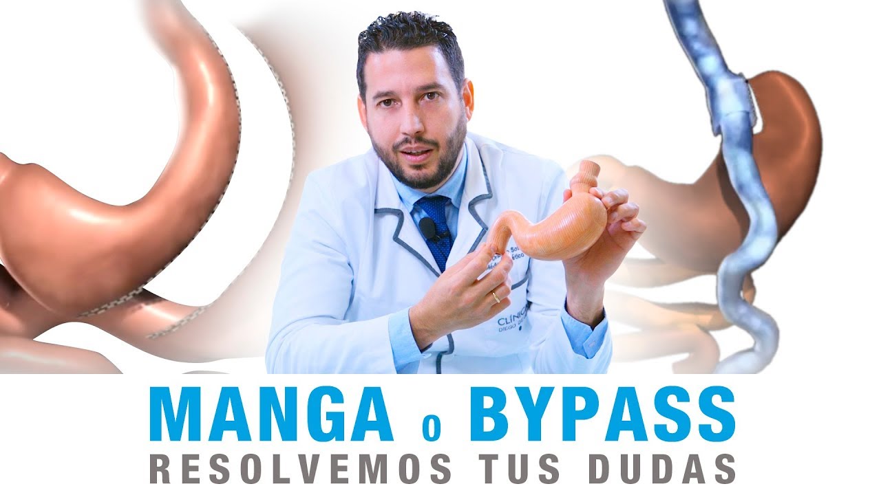 reducción de estómago pros y contras