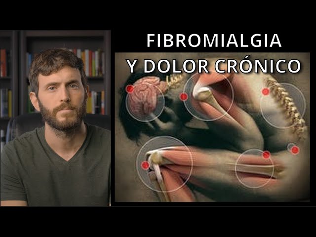 se puede tener esclerosis múltiple y fibromialgia a la vez