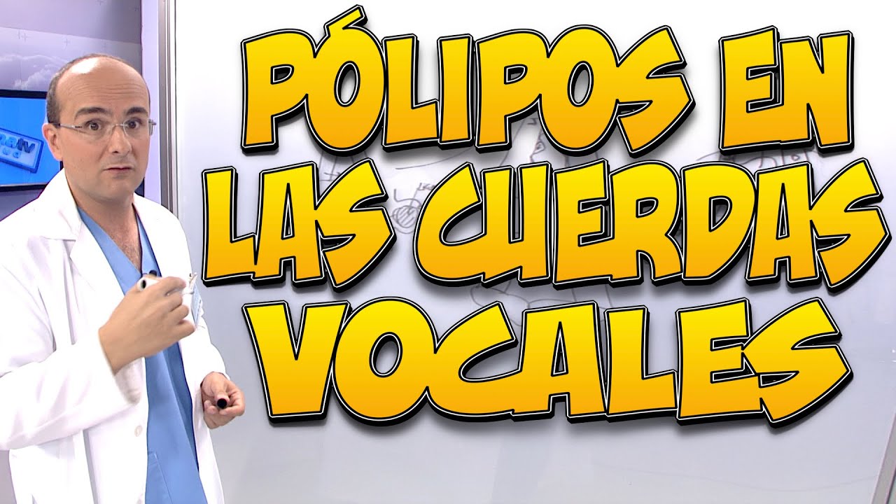 síntomas de pólipos en la garganta