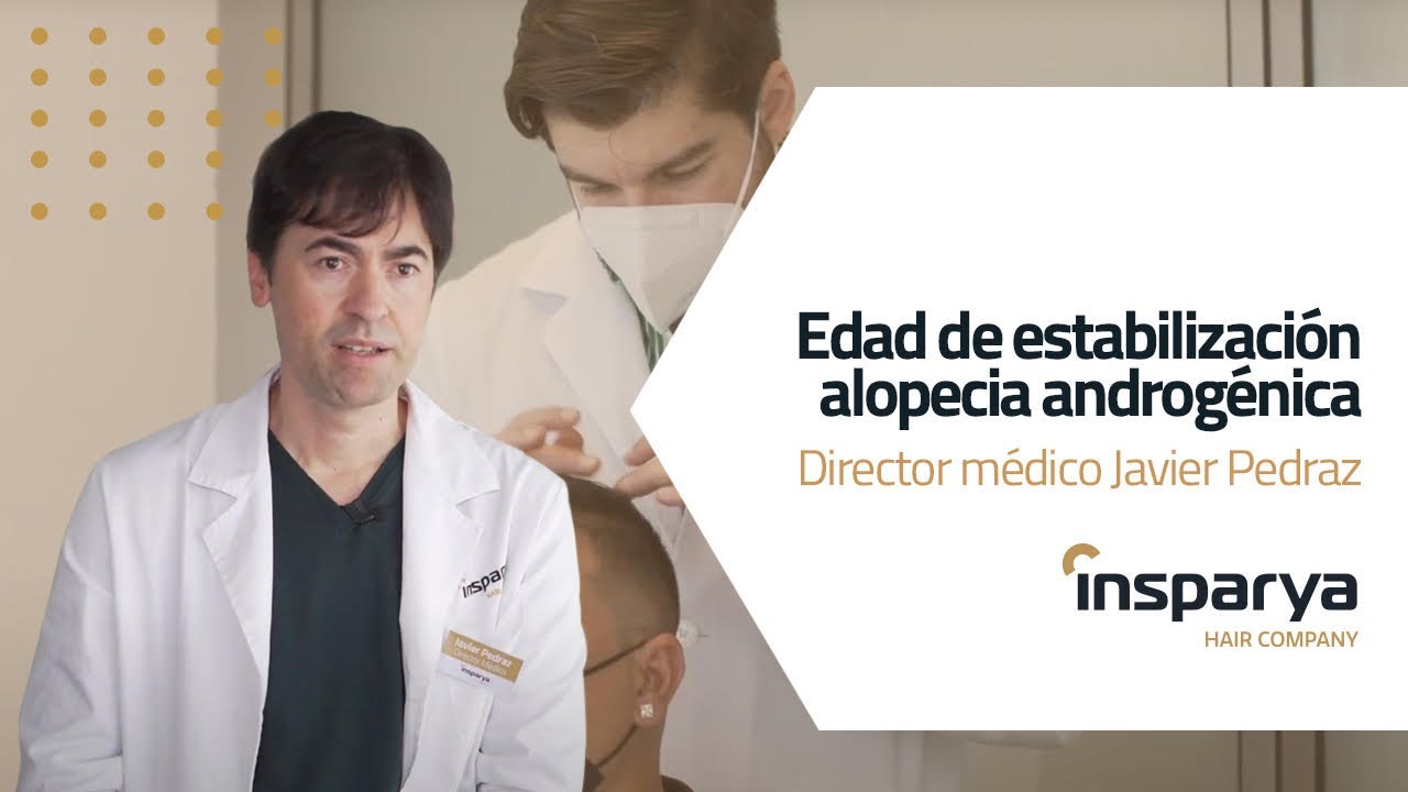 a que edad se estabiliza la alopecia androgenética