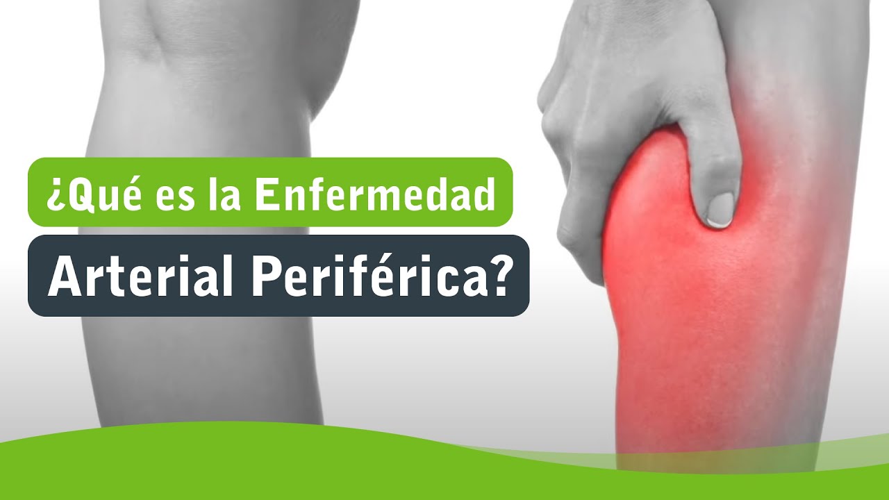 arteriografia periferica de una extremidad inferior por puncion