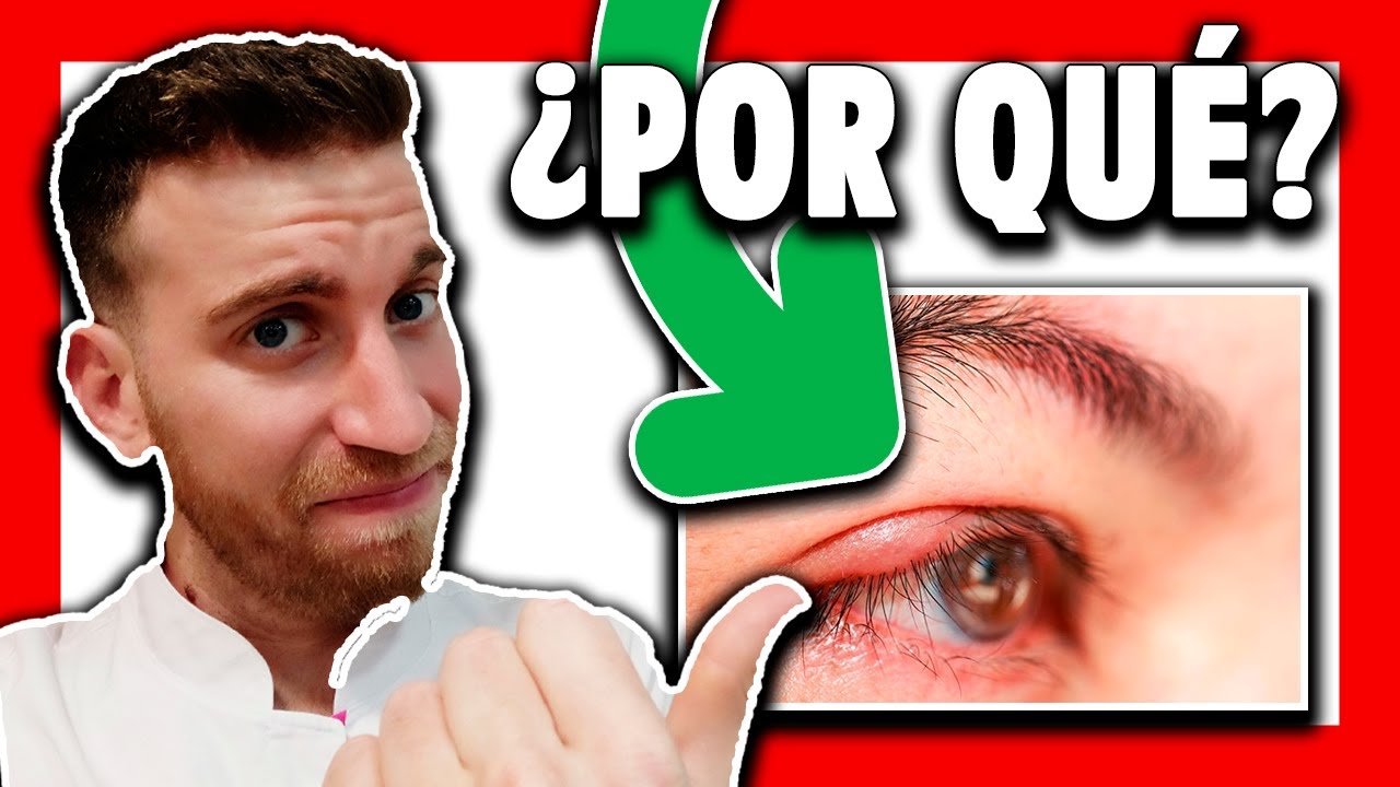 bultos en el parpado superior del ojo