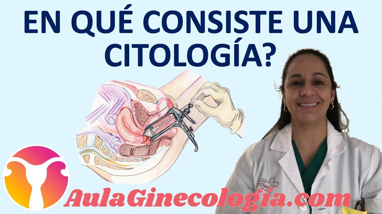 cada cuanto se hacen las citologias
