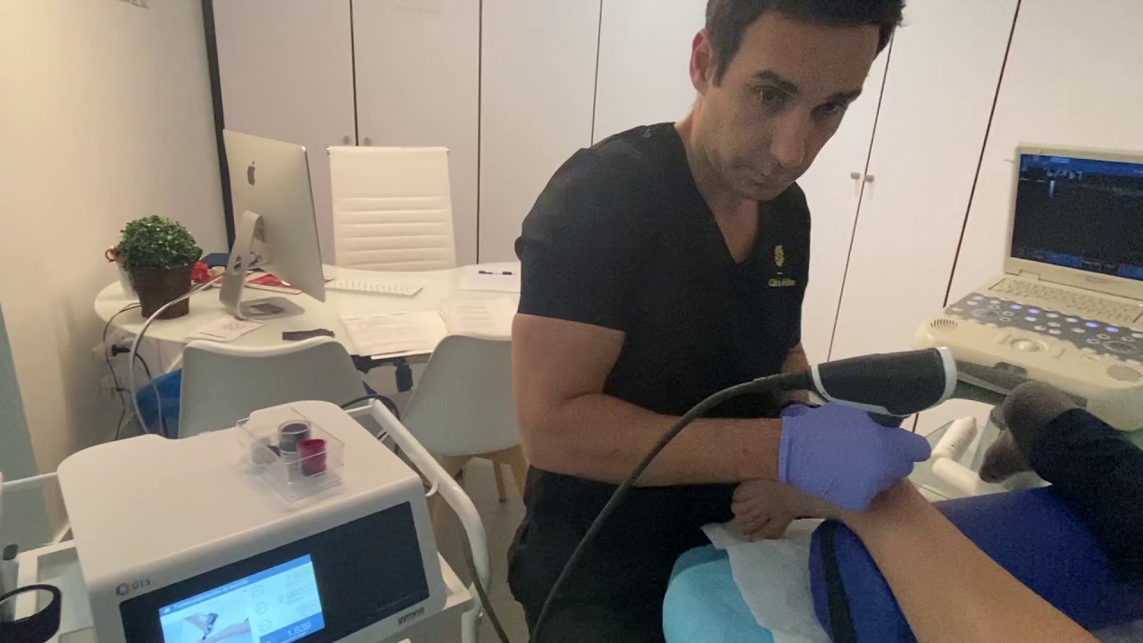 calcificacion en el tendon de aquiles