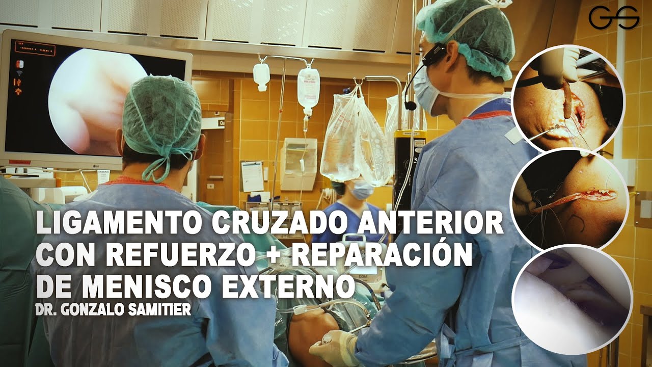 cirugia ligamento cruzado anterior y meniscos