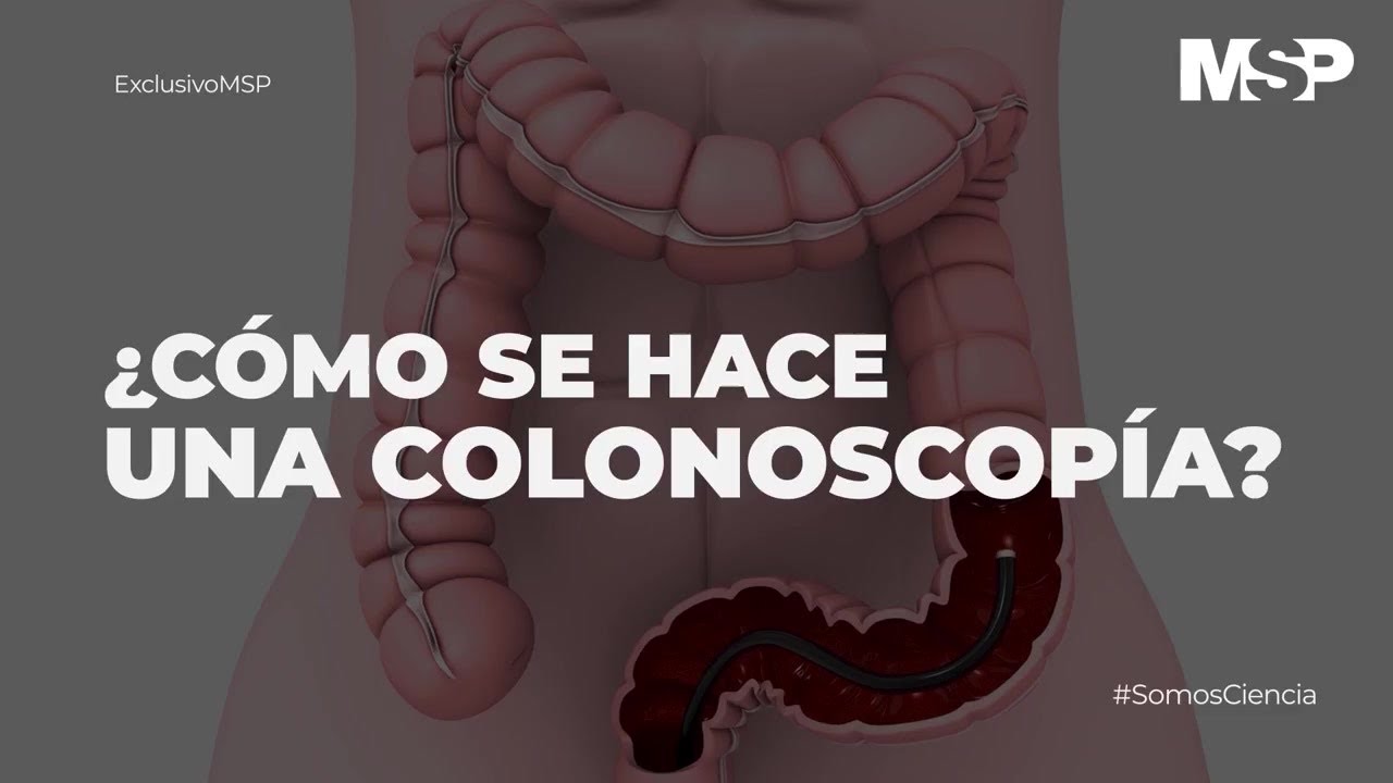 colonoscopia y endoscopia a la vez