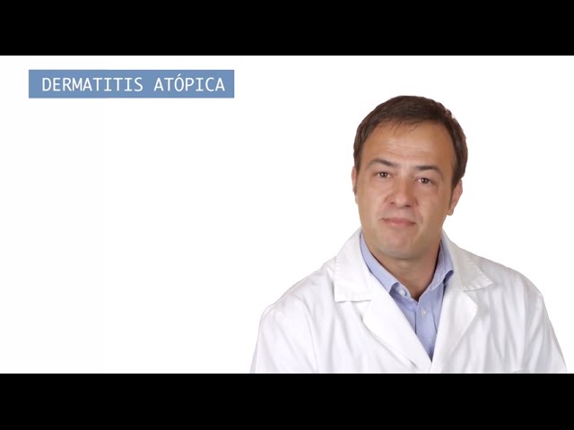 como aliviar picores en la piel