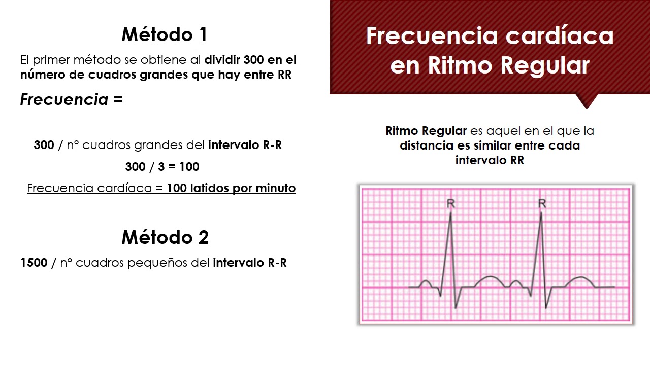 como calcular la frecuencia cardiaca en un electrocardiograma