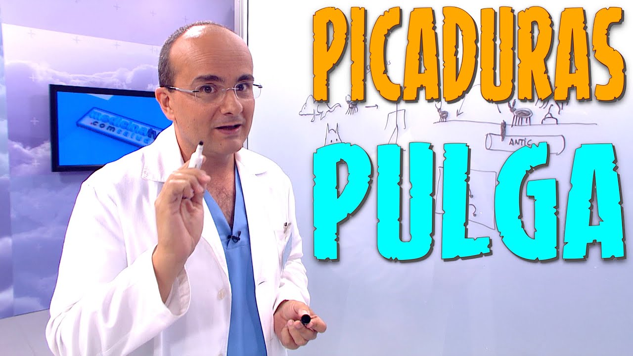 cremas para las picaduras de pulgas