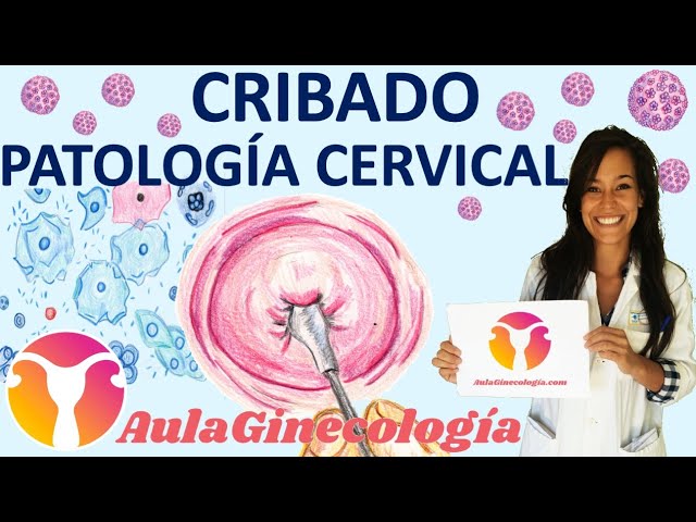 cribado para deteccion de neoplasia cervical maligna