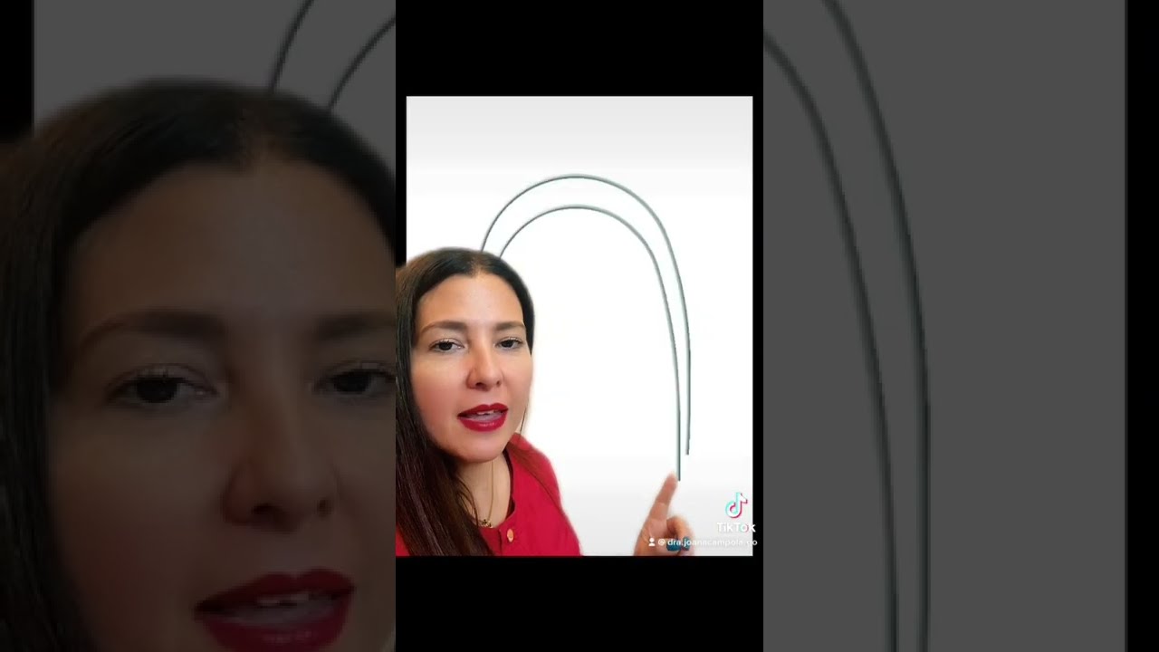 cual es el último arco en ortodoncia
