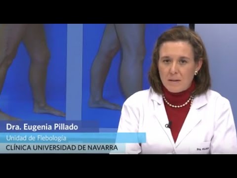 cuando se ven los resultados de la escleroterapia