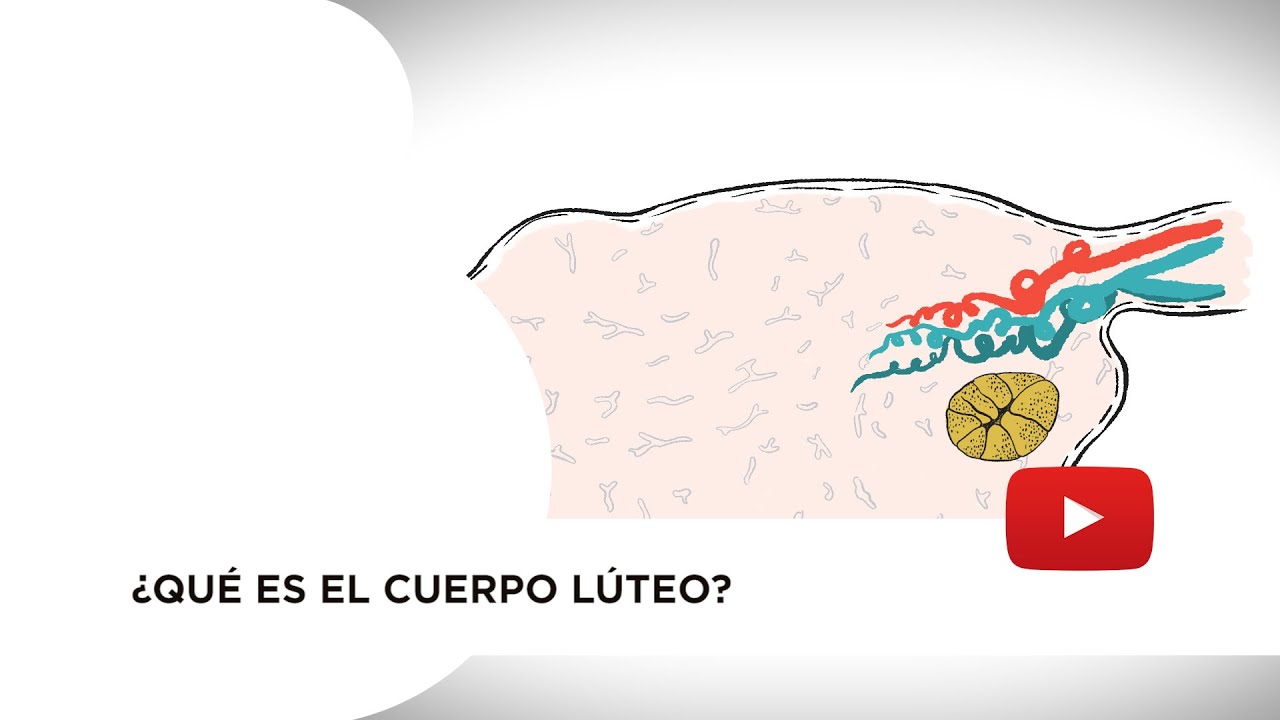 cuerpo lúteo en ovario derecho niño o niña