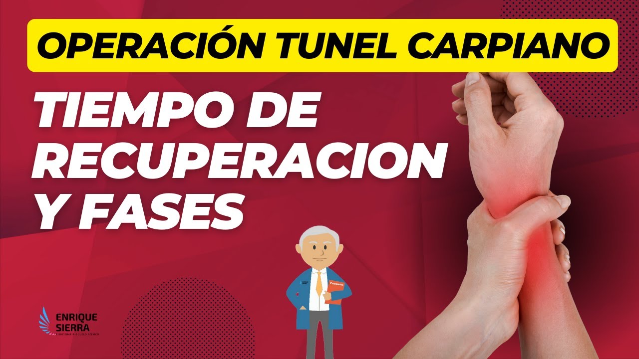 días de baja por operación del túnel carpiano