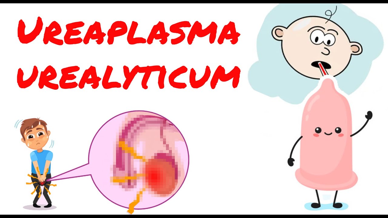 diferencia entre ureaplasma parvum y ureaplasma urealyticum