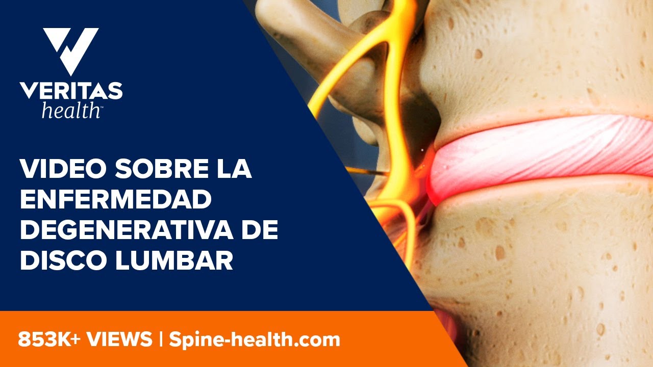 discopatía degenerativa con cambios modic tipo 1 en l5 s1
