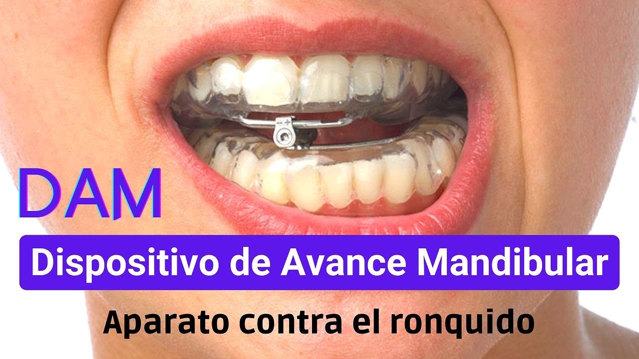 dispositivo de avance mandibular o dam