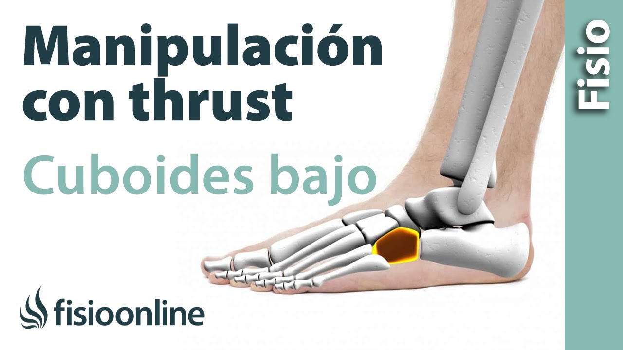 dolor en el cuboides al caminar