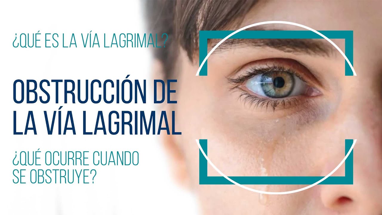 dolor en el lagrimal del ojo