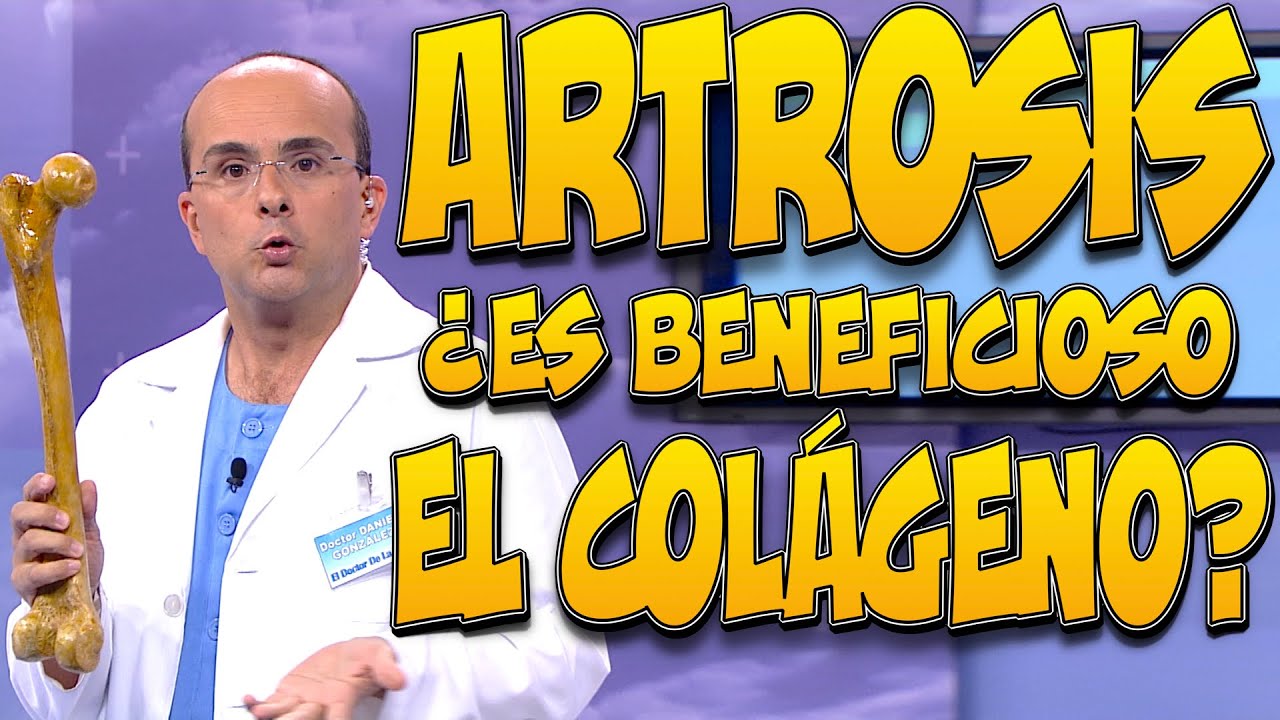 el mejor colageno para la artrosis