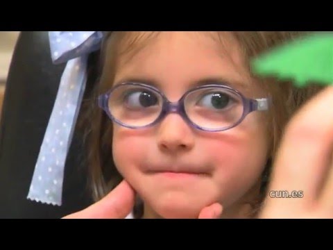 estrabismo en niños de 2 a 3 años