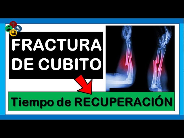 fractura de cúbito y radio tiempo de recuperación