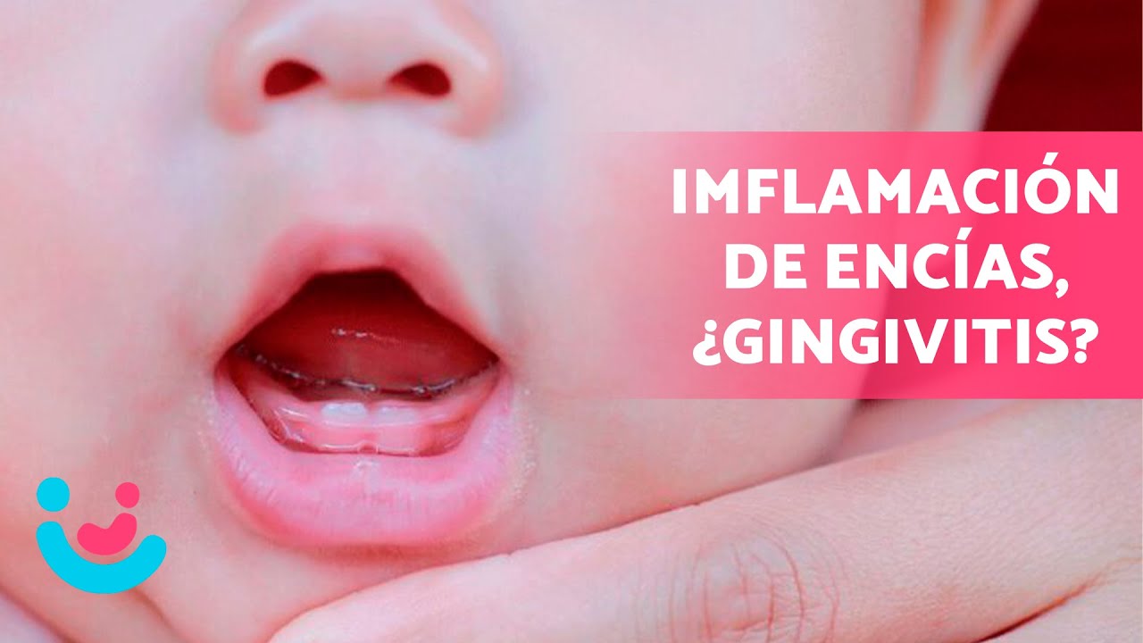 gingivitis en niños de 1 a 2 años tratamiento