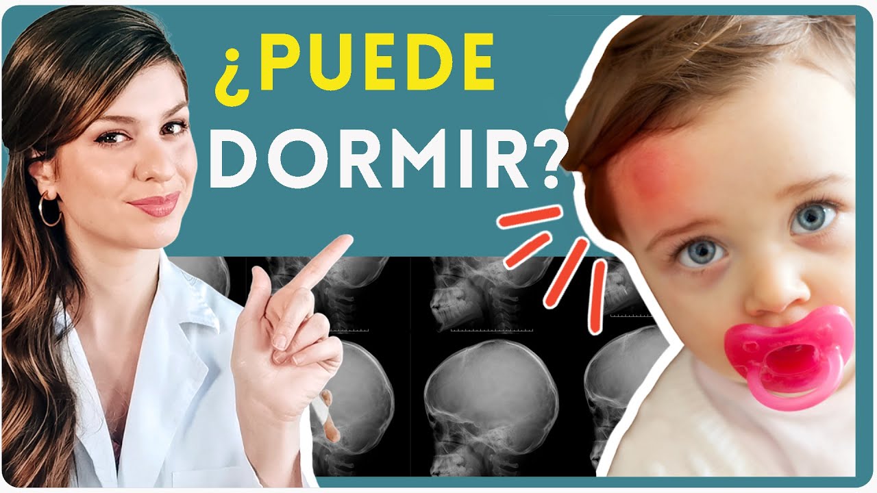golpes en la cabeza del bebe