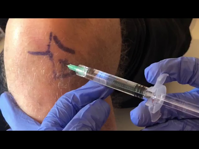 infiltración de acido hialurónico en rodilla