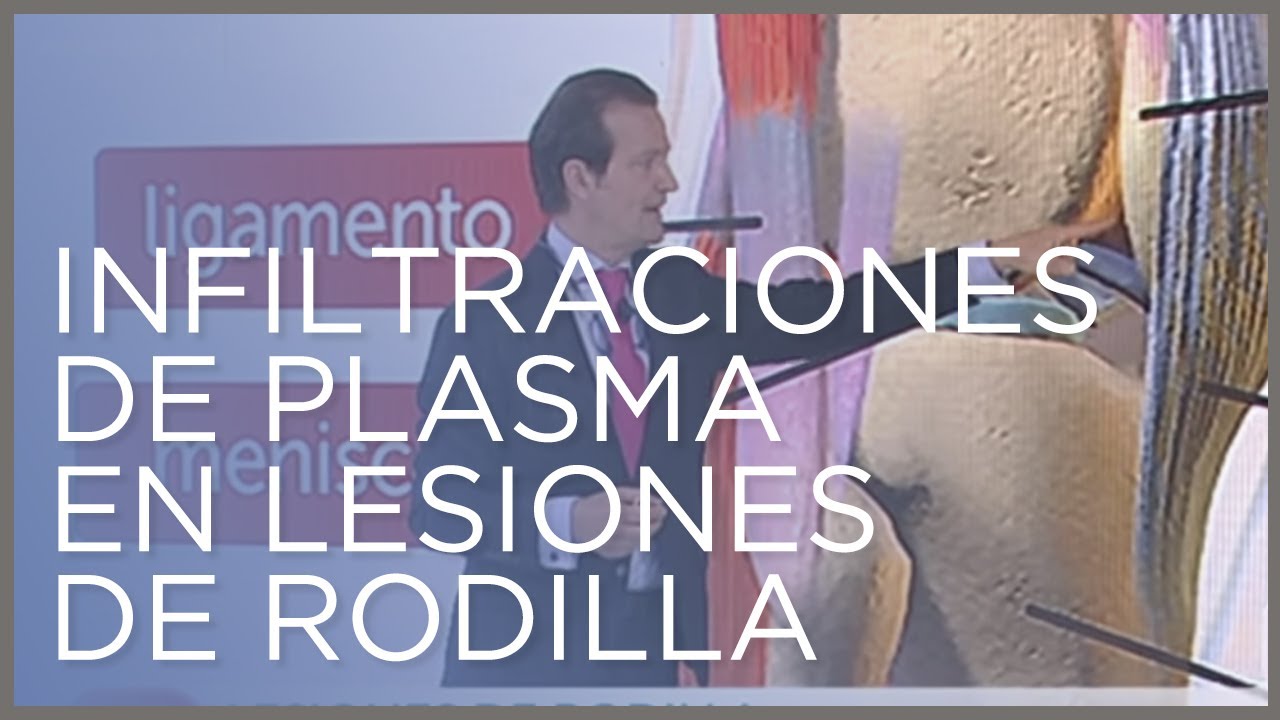 infiltraciones de plasma en las rodillas