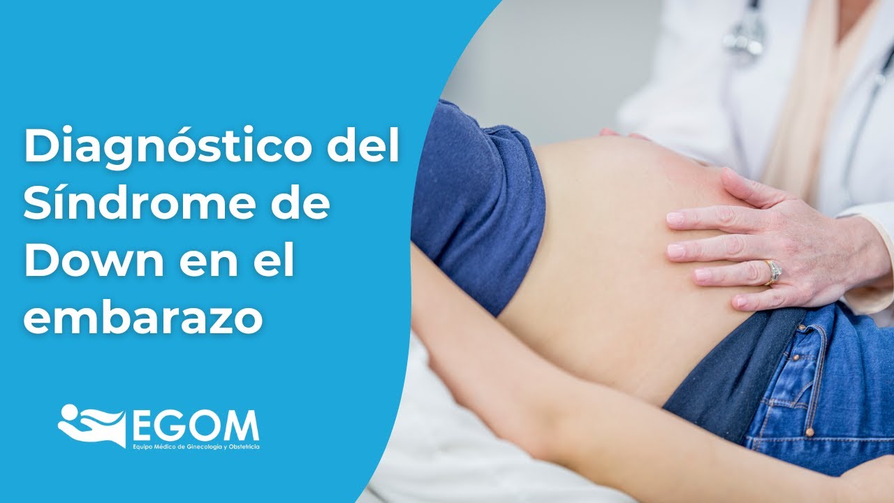 latidos del corazón de un feto con síndrome de down